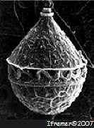Scripsiella trochoidea by electronic microscopy