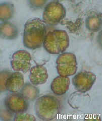 Alexandrium catenella en microscopie photonique